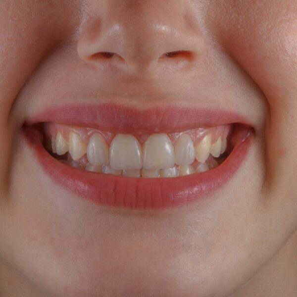 Dents plus blanches sans blanchiment : la routine à 3 minutes